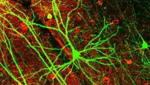 Cerveau et esprit. Fonctions physiques et psychiques du cerveau